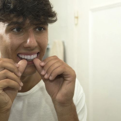 A teenage boy looks in the mirror while inserting clear aligners