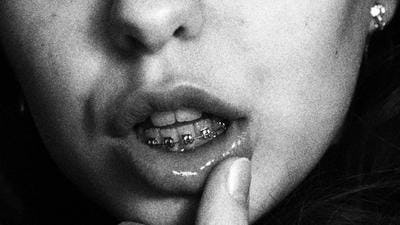 A close up on a women's mouth as she pulls down her bottom lip to reveal a fixed brace
