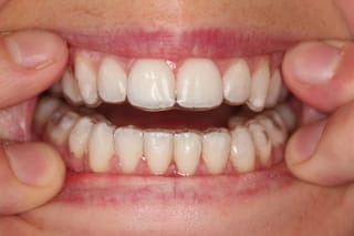 Retainer Photographs 1