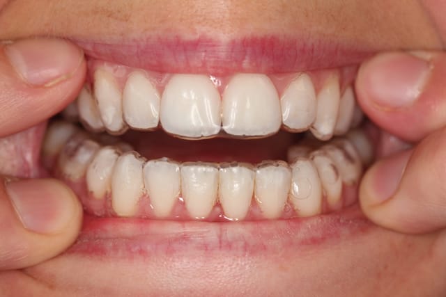 Retainer Photographs 1