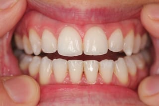 Retainer Photographs 2