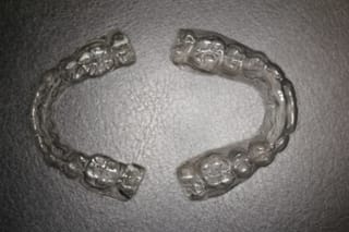 Retainer Photographs 3