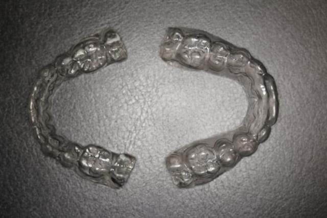 Retainer Photographs 3
