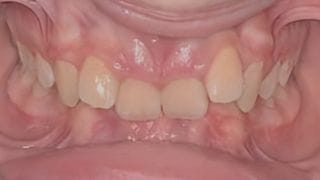 undefined before image