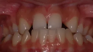 Nayana before image