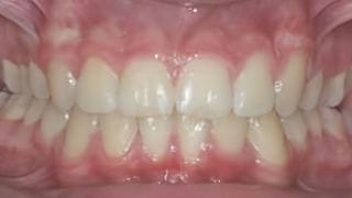 undefined before image