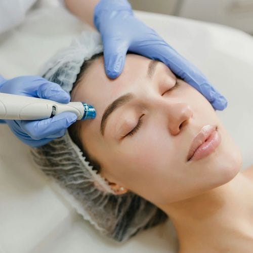 Skin treatment