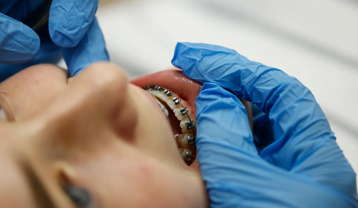 Fixed metal braces are inspected