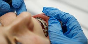 Fixed metal braces are inspected