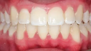 Sarah after image