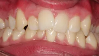 Sarah before image