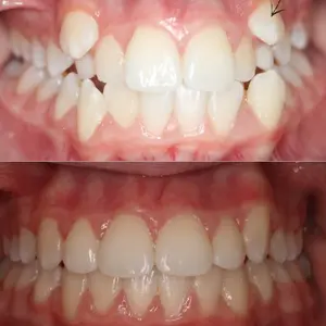 Before & After - patient portrait image