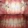 Before & After - patient portrait image