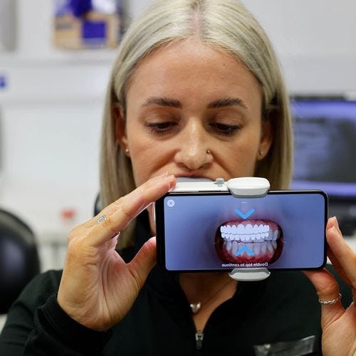 Remote dental monitoring for Invisalign patients in action